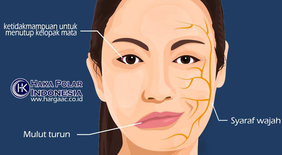 mencegah bell's palsy